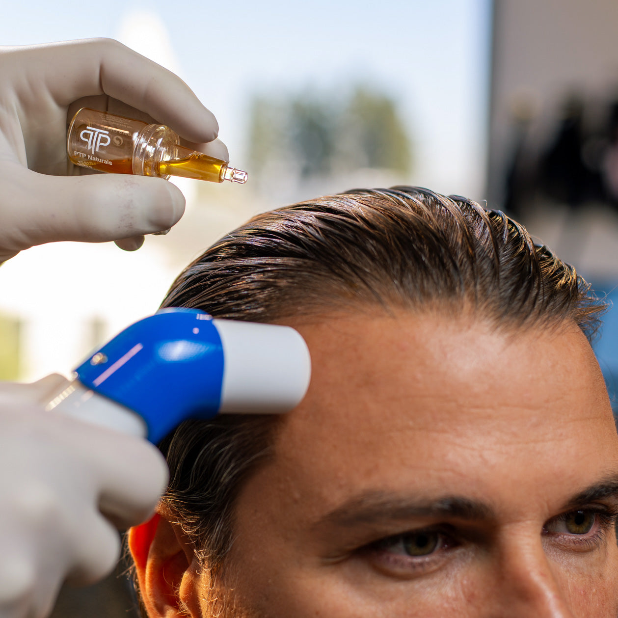 Scalp Restoration Serum (ScRS)